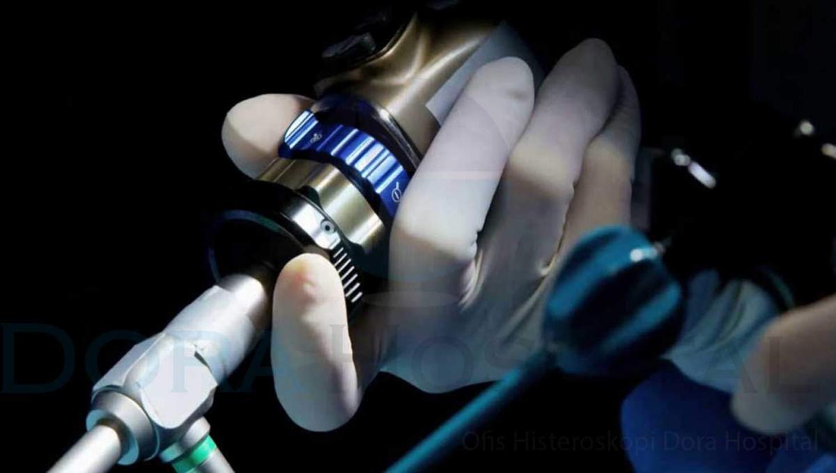 Ofis Histeroskopi