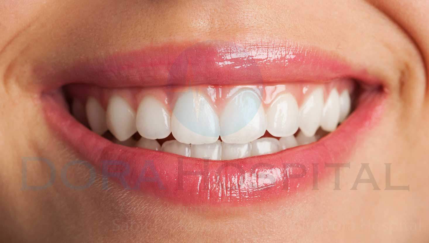 Sabit Protez Diş Nasıl Takılır