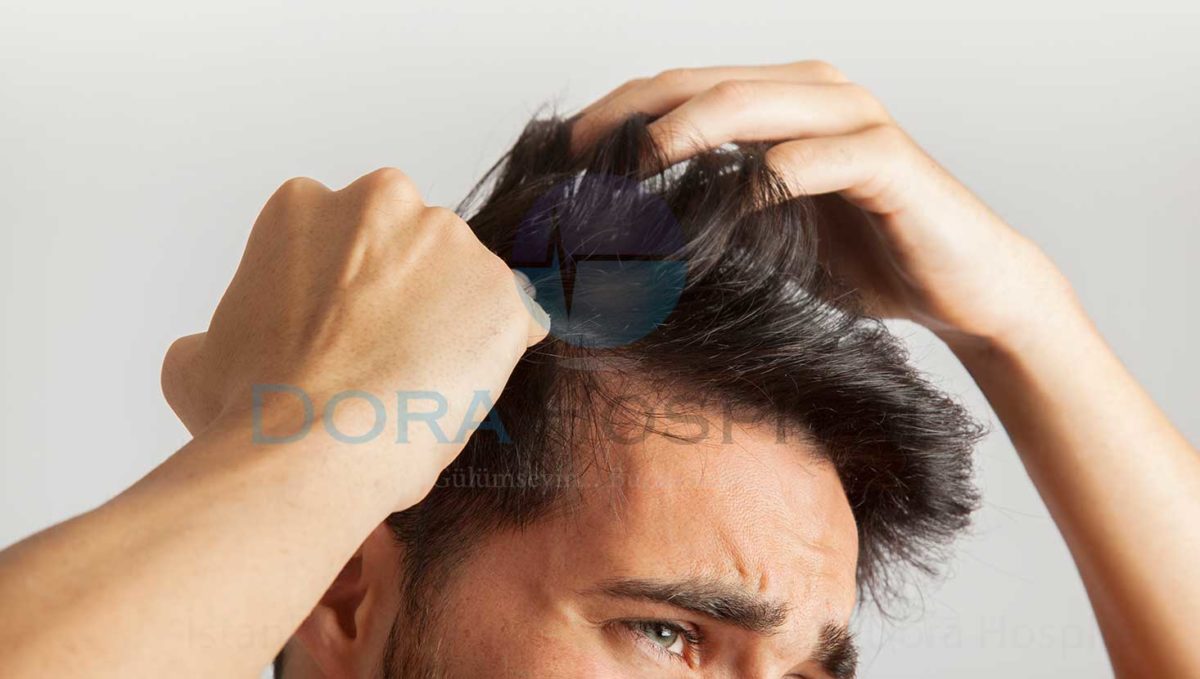 İstanbul Saç Ekimi Fiyatları