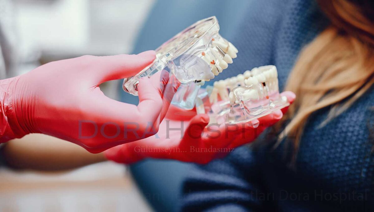İmplant Tedavisi Fiyatları Dora Hospital