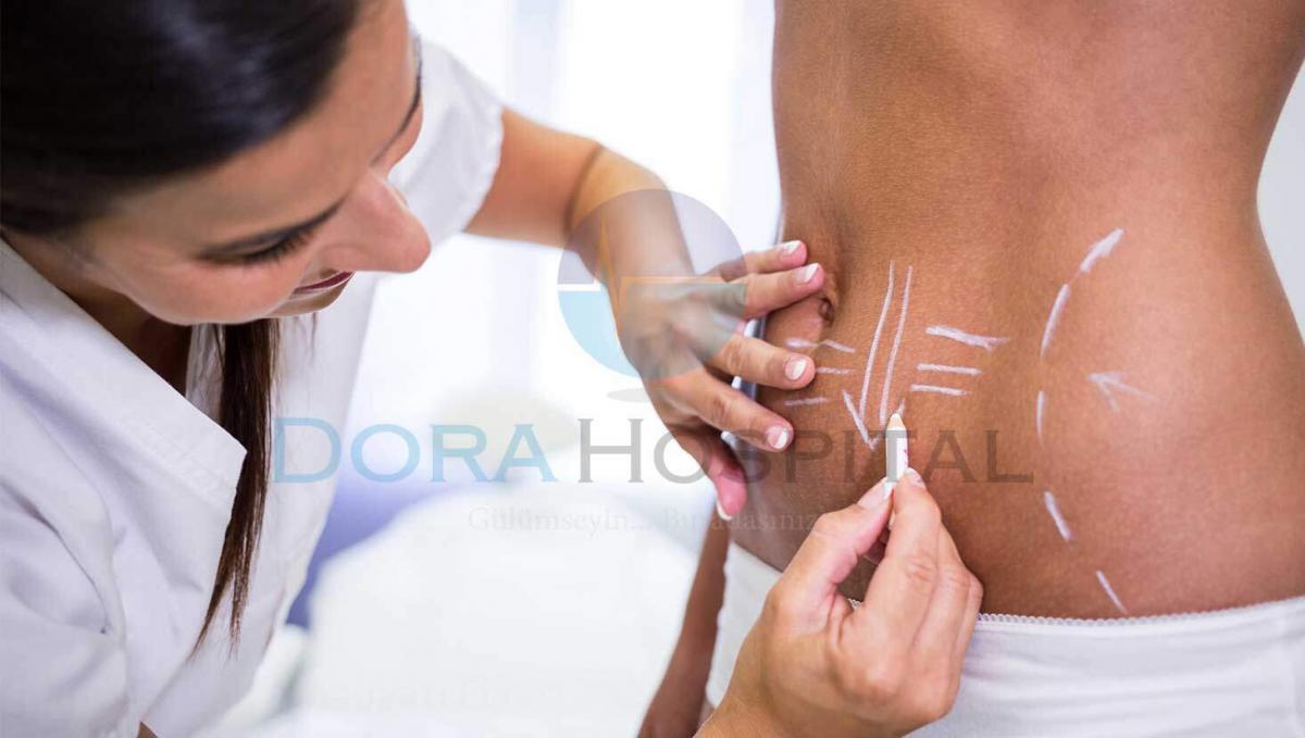 Karın Germe Ameliyatı Fiyatı