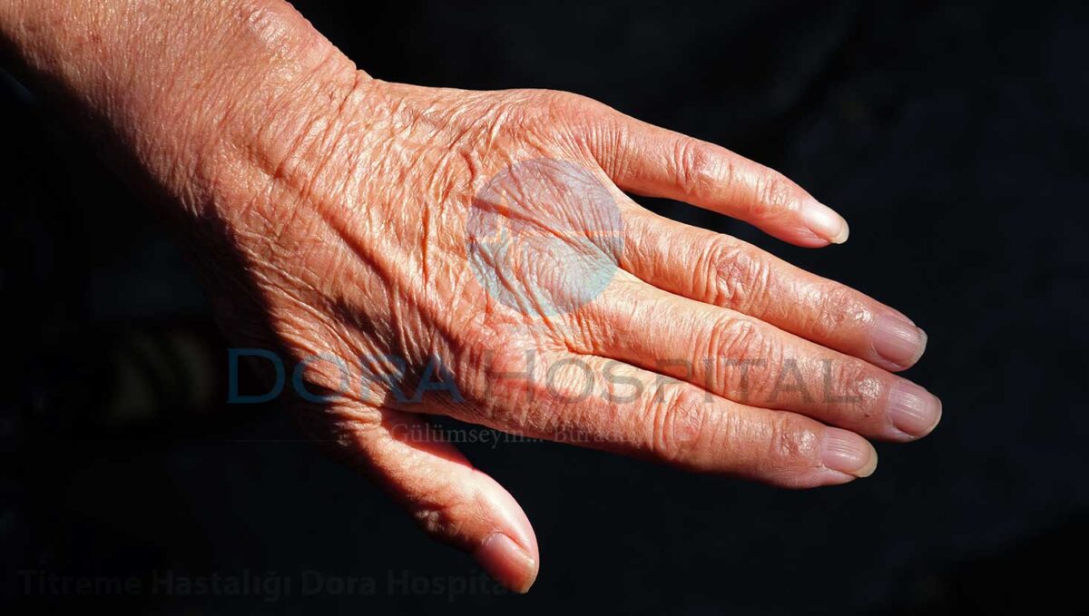 Titreme Hastalığı