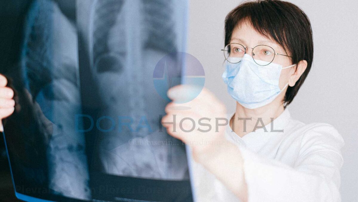 Plevral Efüzyon (Plörezi)